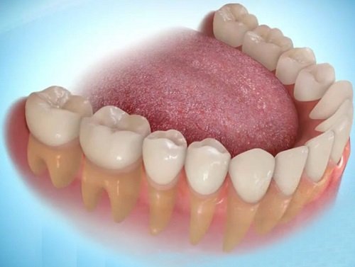 Trồng răng hàm có đau không? Giải đáp thắc mắc-1