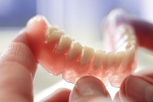 Trồng răng hàm có đau không? Giải đáp thắc mắc-2