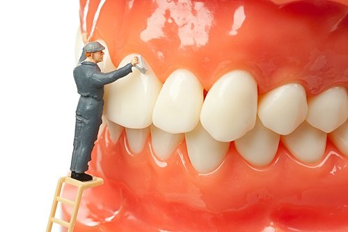 Cạo vôi răng có lợi không? Tìm hiểu thông tin cụ thể 2