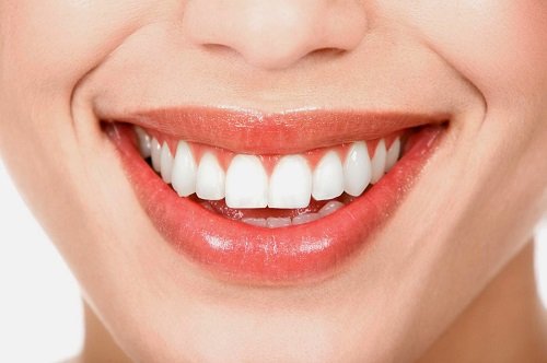 Cạo vôi răng có lợi không? Tìm hiểu thông tin cụ thể 3