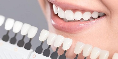 Làm răng sứ không mài răng - Thông tin bạn cần tìm hiểu