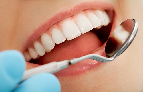 Làm răng sứ thẩm mỹ loại nào tốt nhất hiện nay? 1