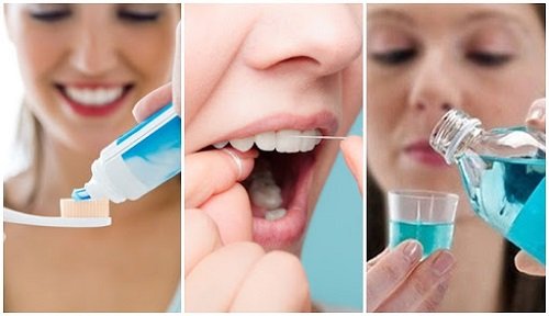 Niềng răng không mắc cài mất bao lâu? Các vấn đề bạn nên biết 4