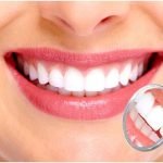 Lắp răng sứ bị sưng lợi - Cách khắc phục hiệu quả