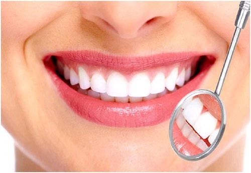 Lắp răng sứ bị sưng lợi - Cách khắc phục hiệu quả