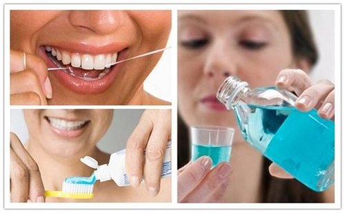 Tẩy trắng răng bị nhiễm tetracycline cho bạn hiệu quả 3