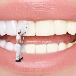 Có nên tẩy trắng răng nhiều lần hay không? Tin nha khoa