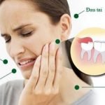 Răng khôn bị mọc lệch - Cách khắc phục hiệu quả