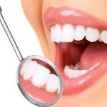 Răng sứ bị nứt phải làm sao để xử lý? Nha khoa răng sứ