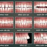 Điều trị răng miệng thẩm mỹ tại nha khoa