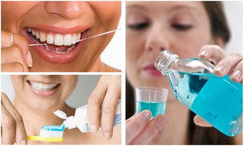Tẩy trắng răng duy trì được bao lâu? Cần kiêng cử gì? 3