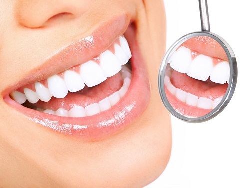 Tẩy trắng răng trong 1 tuần với phương pháp nào? 2