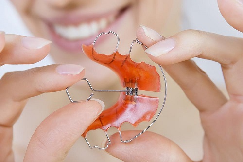 Niềng răng phải đeo hàm duy trì bao lâu là được? 1