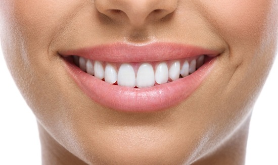 Chi phí cạo vôi răng có cao không - Niềng răng thẩm mỹ uy tín
